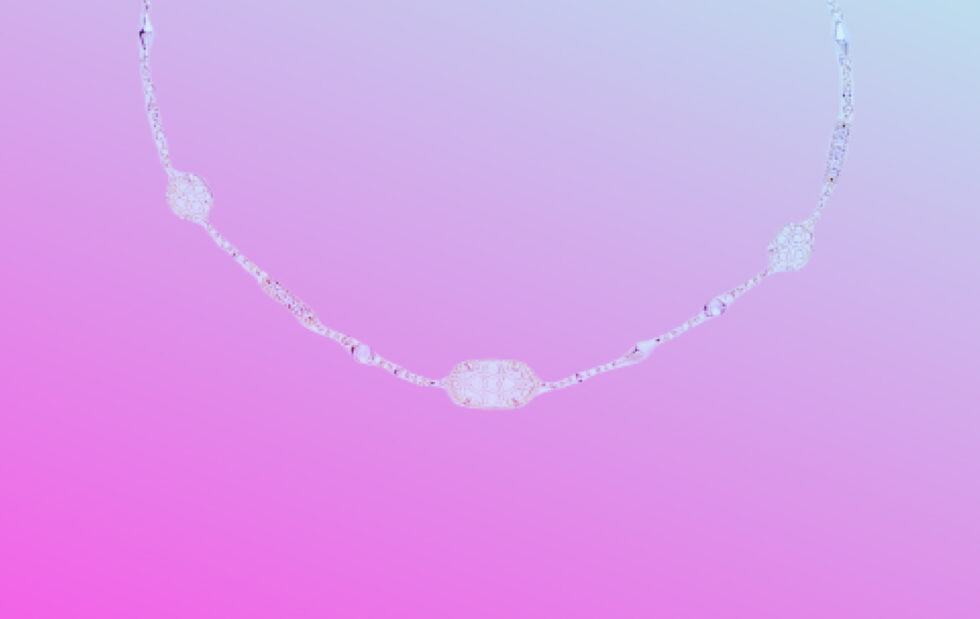 Case Study Archives Arm Candy